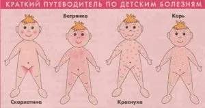 Висип на стегнах у дитини