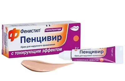 Як вилікувати герпес назавжди чи можна і як повністю позбутися від вірусу