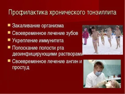 Як вилікувати хронічний тонзиліт раз і назавжди в домашніх умовах народними засобами у (тонзиліт) Як вилікувати хронічний тонзиліт раз і назавжди в домашніх умовах народними засобами у