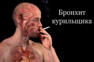 Кашель курця як позбутися, симптоми і лікування в домашніх умовах (домашніх) Кашель курця як позбутися, симптоми і лікування в домашніх умовах