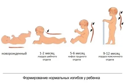 Кіфоз, лордоз і сколіоз хребта (хребта) Кіфоз, лордоз і сколіоз хребта