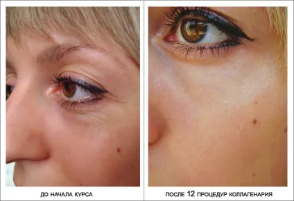 Коллагенарій - апаратна косметологія - Велеслава (Велеслава) Коллагенарій - апаратна косметологія - Велеслава
