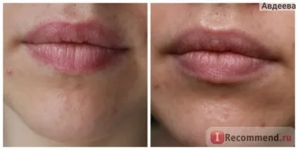Крем для обличчя avene зволожуючий крем-перфектор кольору і тону особи spf 30 (hydrance optimale (особи) Крем для обличчя avene зволожуючий крем-перфектор кольору і тону особи spf 30 (hydrance optimale