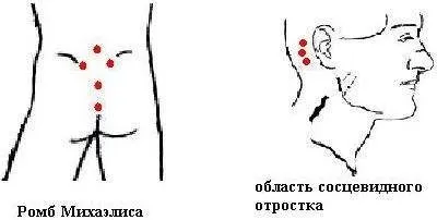 Лікування гіпертонії в домашніх умовах народними засобами (лікування) Лікування гіпертонії в домашніх умовах народними засобами