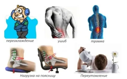 Лікування люмбалгии поперекового відділу хребта