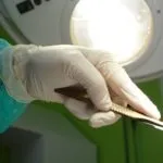 Лікування вазомоторного риніту лазером - відгуки, діагностика захворювання і відео як робиться операція (риніту) Лікування вазомоторного риніту лазером - відгуки, діагностика захворювання і відео як робиться операція
