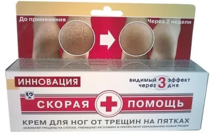 Лікування тріщин на п'ятах причини і лікування тріщин на п'ятах в домашніх умовах (лікування) Лікування тріщин на п'ятах причини і лікування тріщин на п'ятах в домашніх умовах