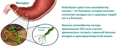 Медикаментозне лікування гастродуоденита у дорослих за допомогою ліків (допомоги) Медикаментозне лікування гастродуоденита у дорослих за допомогою ліків
