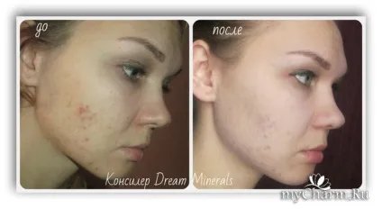 Мінеральний консилер - кращий консилер для шкіри! Dream minerals консилер для жирної шкіри (консилер) Мінеральний консилер - кращий консилер для шкіри! Dream minerals консилер для жирної шкіри