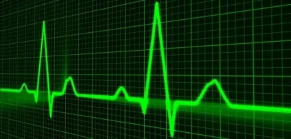 Чи можна померти від пневмонії - мій пульмонолог (померти) Чи можна померти від пневмонії - мій пульмонолог