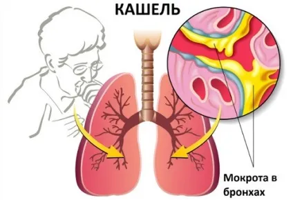 Мукалтин від якого кашлю (якого кашлю Мукалтин) Мукалтин від якого кашлю
