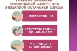 Непрямий масаж серця