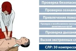 Непрямий масаж серця