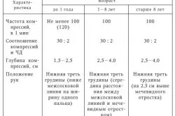 Непрямий масаж серця