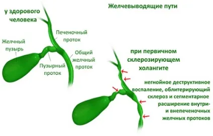 Но-шпа при панкреатиті яка дозування і мета застосування (мета) Но-шпа при панкреатиті яка дозування і мета застосування