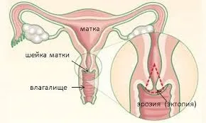 Про що говорять блідо рожеві виділення (блідо рожеві виділення) Про що говорять блідо рожеві виділення