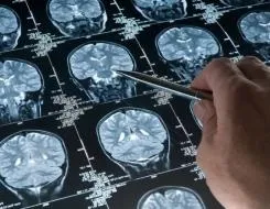 Онкомаркери рання діагностика раку, медафарм - портал про пластичну хірургію, медичному