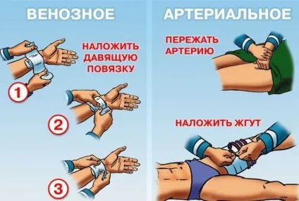 Надання першої допомоги потерпілим при ДТП (допомоги) Надання першої допомоги потерпілим при ДТП