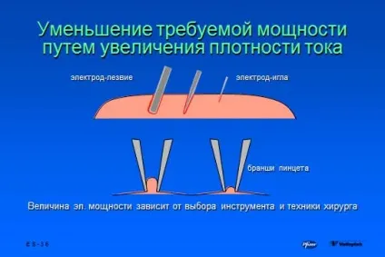 основи електрохірургії
