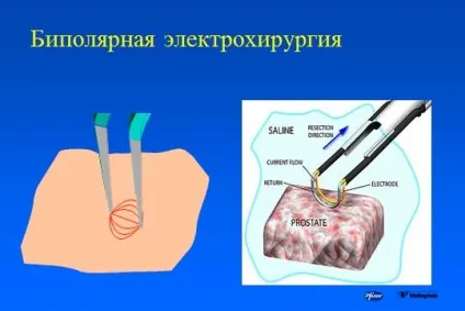 основи електрохірургії