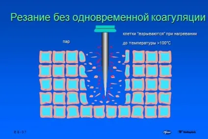 основи електрохірургії