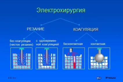 основи електрохірургії