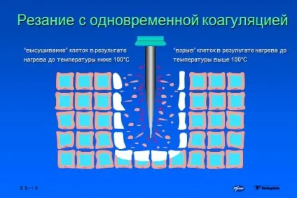 основи електрохірургії