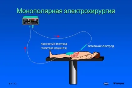 основи електрохірургії