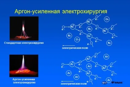 основи електрохірургії
