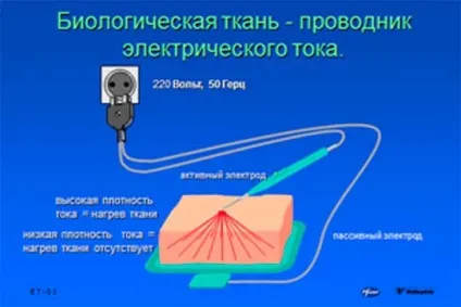 основи електрохірургії