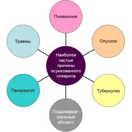 Осумкований плеврит особливості картини, лікувальні заходи (особливо) Осумкований плеврит особливості картини, лікувальні заходи