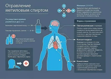 отруєння алкоголем