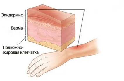 Перша допомога при саднах - очищення рани та профілактика (допомога) Перша допомога при саднах - очищення рани та профілактика