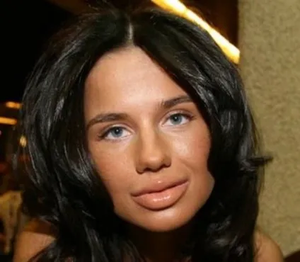 Співачка алекса повернула собі пухкі губи в стилі Джолі (собі) Співачка алекса повернула собі пухкі губи в стилі Джолі