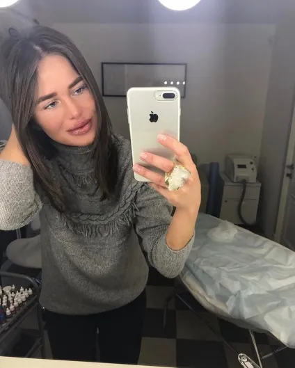 Співачка алекса повернула собі пухкі губи в стилі Джолі (собі) Співачка алекса повернула собі пухкі губи в стилі Джолі