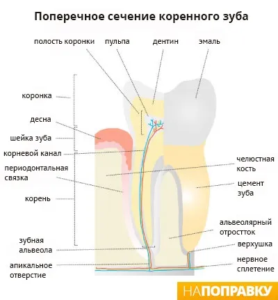 Пломбування зубів (зубних каналів) загальні відомості і догляд - напоправку (зубних) Пломбування зубів (зубних каналів) загальні відомості і догляд - напоправку