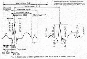 Правильна розшифровка ЕКГ (електричний імпульс проходить) Правильна розшифровка ЕКГ
