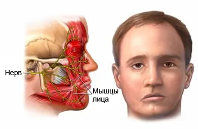 Препарати і ліки при ішемічному інсульті головного мозку (головного) Препарати і ліки при ішемічному інсульті головного мозку