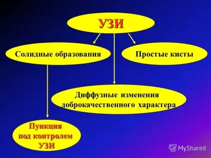 Презентація на тему тема ультразвукова анатомія молочної залози (презентація) Презентація на тему тема ультразвукова анатомія молочної залози