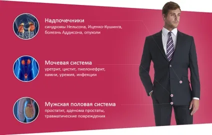 Прийом уролога, запис на платний огляд, консультацію, приватна клініка «династія», Запоріжжя (платний) Прийом уролога, запис на платний огляд, консультацію, приватна клініка «династія», Запоріжжя