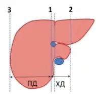 Розміри печінки і жовчного міхура на УЗД (лекція на діагностере) (печінки) Розміри печінки і жовчного міхура на УЗД (лекція на діагностере)