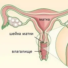 Розрив шийки матки 1 ступеня при пологах наслідки (розрив шийки матки 1 ступеня при пологах наслідки) Розрив шийки матки 1 ступеня при пологах наслідки