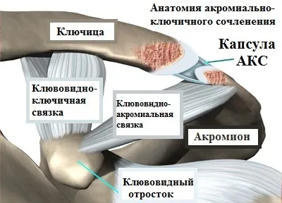 Розрив зв'язок акромиально-ключичного зчленування плеча (зчленування) Розрив зв'язок акромиально-ключичного зчленування плеча