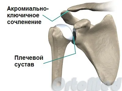 Розрив акромиально-ключичного зчленування симптоми, лікування, операція, розрив акроміальних зв'язок (зчленування) Розрив акромиально-ключичного зчленування симптоми, лікування, операція, розрив акроміальних зв'язок