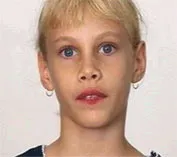 ротовий дихання