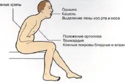 Серцева недостатність що це, види і класи (види) Серцева недостатність що це, види і класи