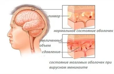 Шишка на шиї у дитини збоку, з двох сторін що це може бути (двох) Шишка на шиї у дитини збоку, з двох сторін що це може бути