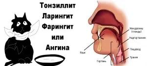 Сильний біль в горлі при ковтанні лікування, причини виникнення