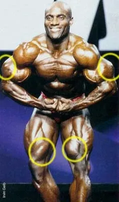 Синтол (synthol)