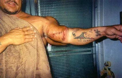 Синтол (synthol)